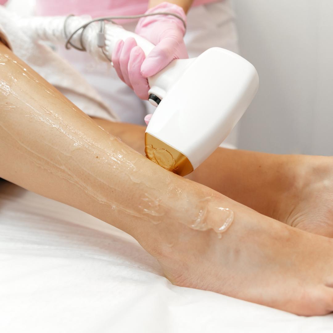 Cera La Depilacion Laser Es Dolorosa Depilación Laser Diodo, Mitad